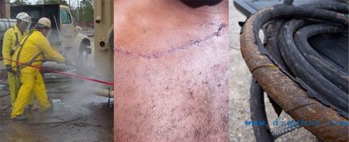 高壓清洗機工作中應注意的（de）安全問（wèn）題